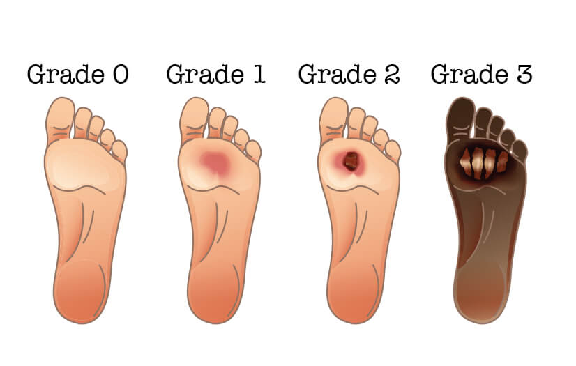 Thumb immense diabetes & thyriod clinics